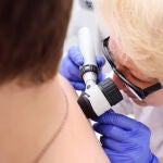 Este tipo de cáncer de piel es potencialmente curable cuando se trata en sus estadíos iniciales