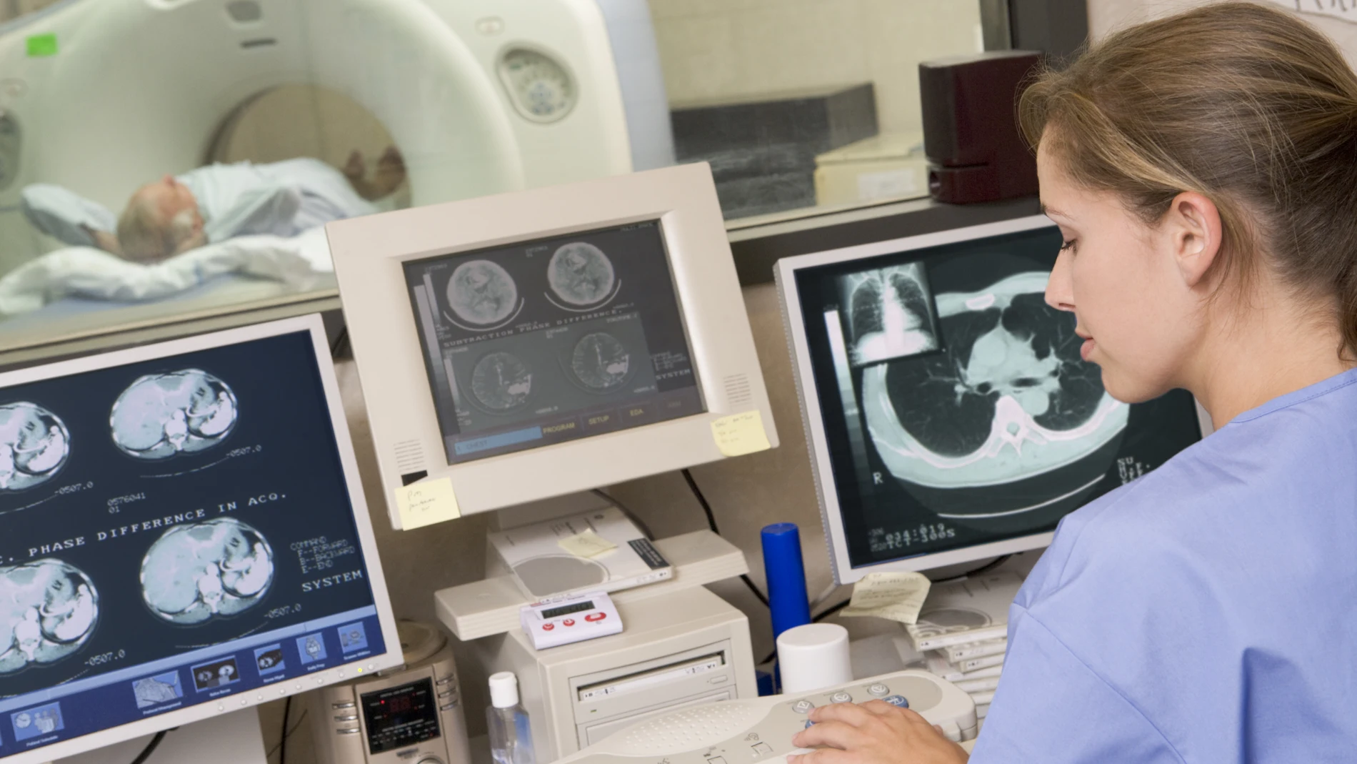 El TAC de baja dosis es la prueba con la que se realiza el cribado de este tipo de cáncer