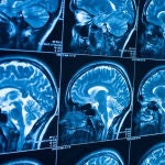 Cuando una parte del cuerpo se ve afectada, la actividad neuronal de una zona concreta de la corteza cerebral se activa | Fotografía de archivo