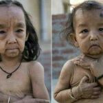 Los niños tomaron la forma de personas mayores, con piel arrugada y dolores articulares