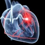 Descubren qué síntoma es peor en caso de infarto: ¿dificultad para respirar o dolor de pecho?