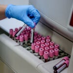 El Centro Nacional de Microbiología confirma el segundo caso de viruela del mono en la Región de Murcia