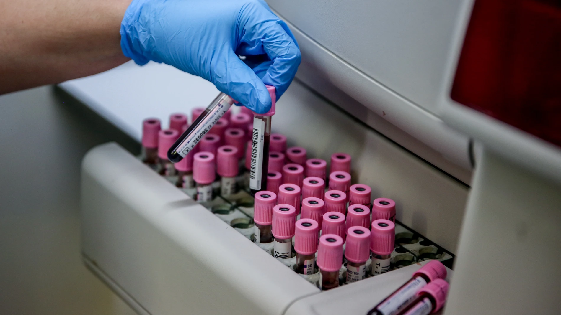 El Centro Nacional de Microbiología confirma el segundo caso de viruela del mono en la Región de Murcia