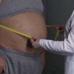 El experimento en ratones ha demostrado que han perdido 40 por ciento de grasa subcutánea, a pesar de tener una dieta alta en grasas