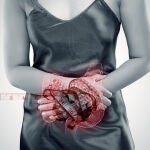 El cáncer colorrectal es el más prevalente en España