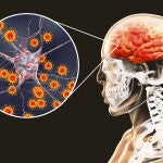 Emergencia sanitaria por dos muertos por meningitis tras realizarse operaciones estéticas