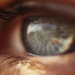 El glaucoma es la segunda causa de ceguera en el mundo.