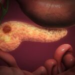 El cáncer de páncreas es uno de los que presenta peores tasas de superviviencia