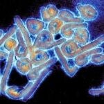 Virus de Marburgo