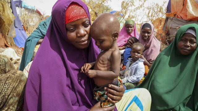 Hambre en Somalia.
