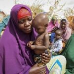 Hambre en Somalia.