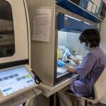 Procesamiento de muestras para PCR de Monkeypox
