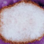 Partícula amplificada del virus de la viruela del mono