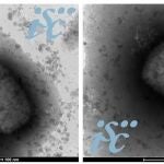Dos imágenes, obtenidas por microscopía electrónica, del virus de la viruela del mono. Imagen: Unidad de Microscopía Electrónica del ISCIII