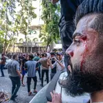 Un palestino herido en Ciudad de Gaza