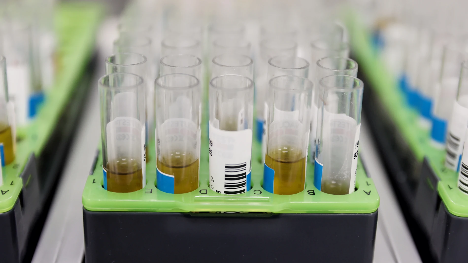 Probetas de pruebas PCR para la viruela del mono