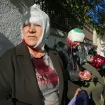 La capital ucraniana Kyiv, que estaba inmune a los bombardeos en los últimos meses, fue golpeada fuertemente por Rusia