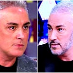 El antes y después de Kiko Hernández