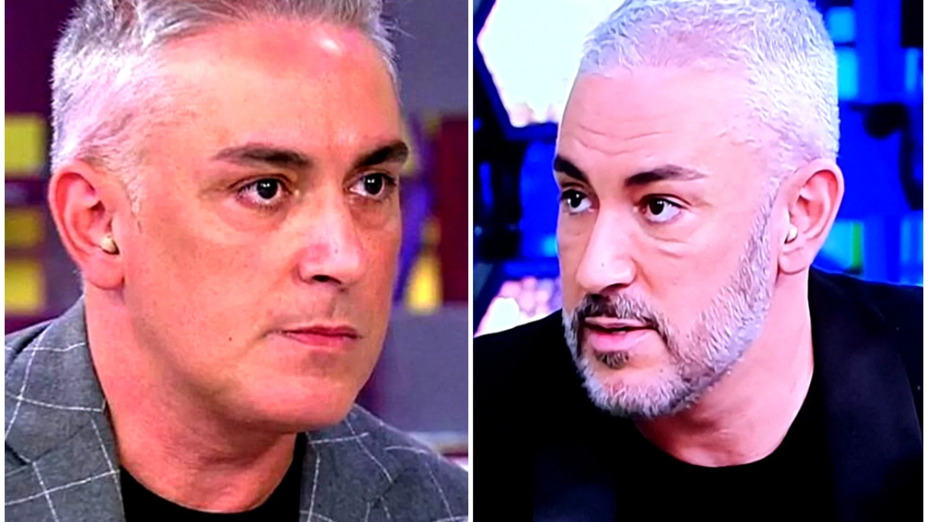 El antes y después de Kiko Hernández