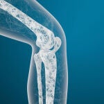 Osteoporosis: qué es y cómo prevenir esta enfermedad ósea