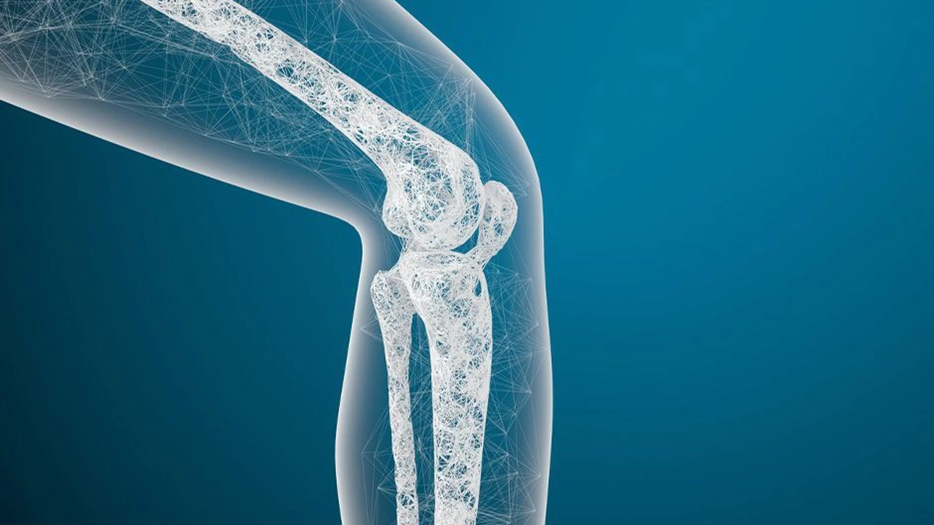 Osteoporosis: qué es y cómo prevenir esta enfermedad ósea