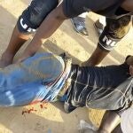 Un manifestante herido es ayudado por sus compañeros.