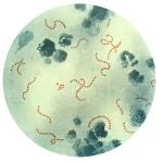 Un hombre de 38 años es la quinta persona en morir en Argentina a causa de la bacteria 'streptococcus pyogenes'. Los otros cuatro fallecidos confirmados son todos niños, las últimas dos niñas de seis y siete años de edadPUBLIC HEALTH IMAGE LIBRARY (Foto de ARCHIVO)12/09/2018