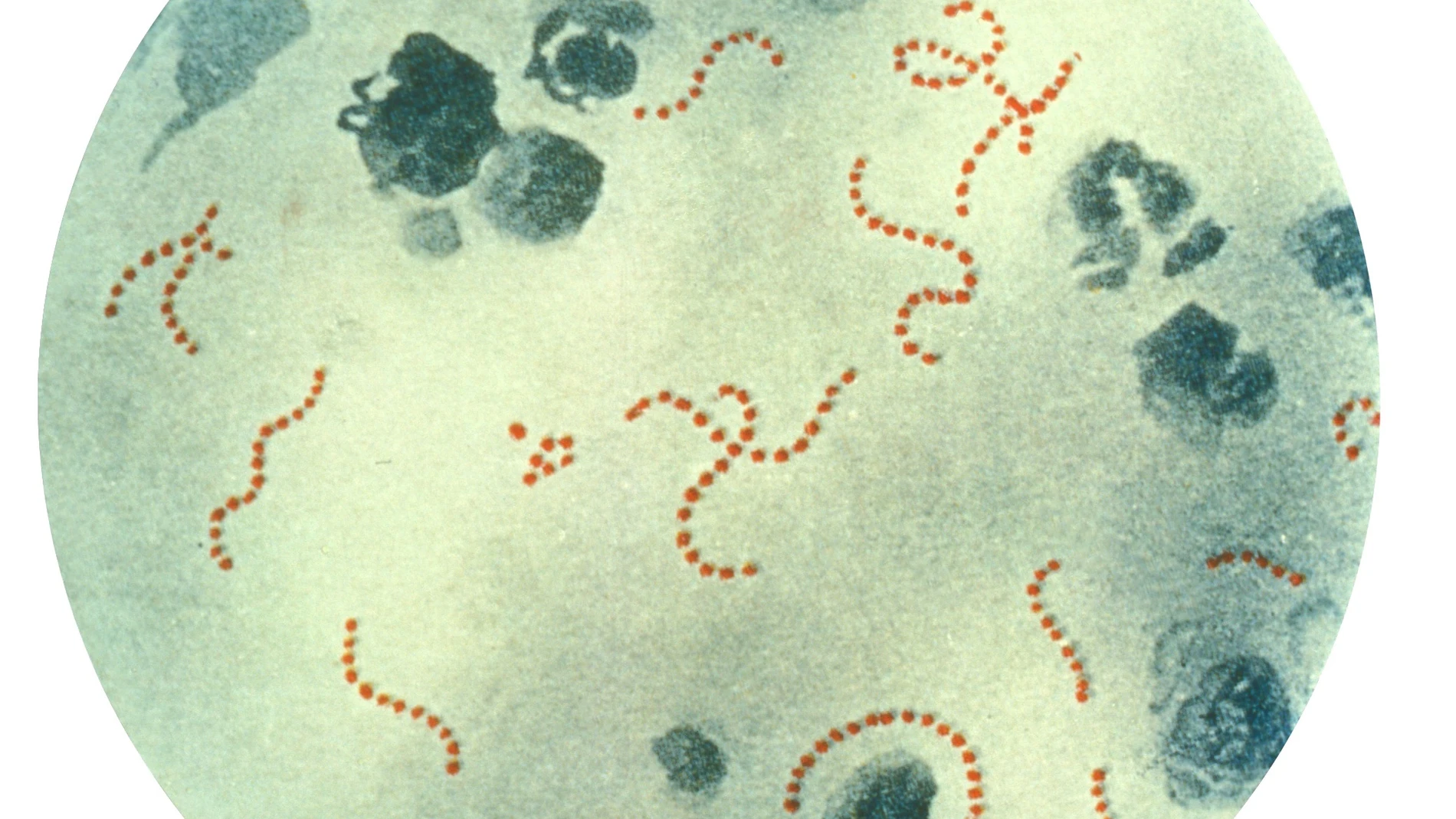 Un hombre de 38 años es la quinta persona en morir en Argentina a causa de la bacteria 'streptococcus pyogenes'. Los otros cuatro fallecidos confirmados son todos niños, las últimas dos niñas de seis y siete años de edadPUBLIC HEALTH IMAGE LIBRARY (Foto de ARCHIVO)12/09/2018