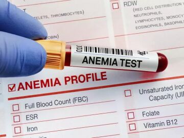 10 preguntas y respuestas sobre la anemia