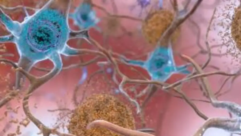 Células de un cerebro