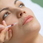 Tratamiento de belleza con ácido hialurónico