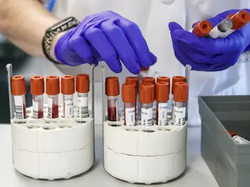 GRAF3673. ZARAGOZA, 05/07/2022.- Personal técnico de laboratorio prepara unas muestras para analizar. La cadena robotizada de serología y biología molecular que permite obtener el 93 % de los resultados de las pruebas en el día ya funciona a pleno rendimiento y cubre áreas de la Microbiología como COVID, VIH, hepatitis, sífilis y sarampión. EFE/Javier Cebollada GRAF3673. ZARAGOZA, 05/07/2022.- Personal técnico de laboratorio prepara unas muestras para analizar. La cadena robotizada de serología y biología molecular que permite obtener el 93 % de los resultados de las pruebas en el día ya funciona a pleno rendimiento y cubre áreas de la Microbiología como COVID, VIH, hepatitis, sífilis y sarampión. EFE/Javier Cebollada