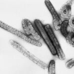 Kenia, Ruanda y Uganda refuerzan su vigilancia tras el brote de virus de Marburgo en Tanzania