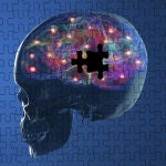 Parkinson