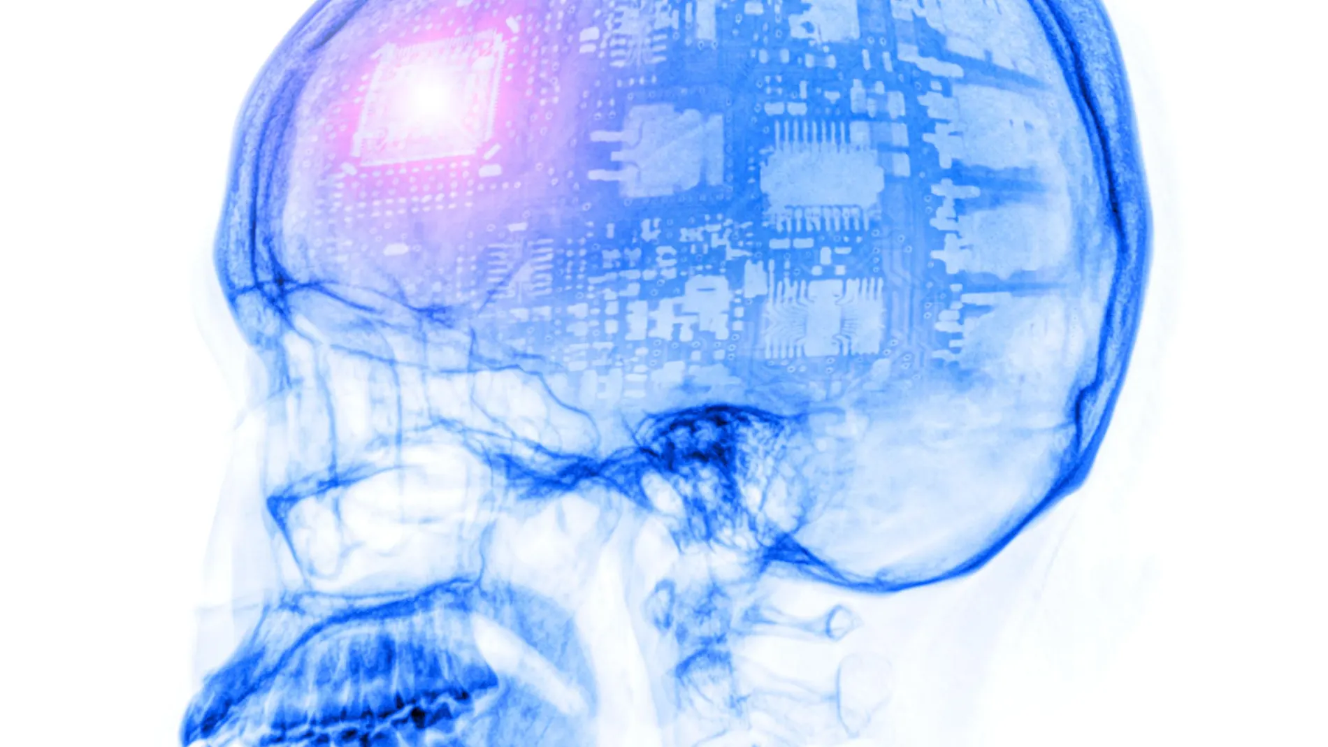 La revolución de la inteligencia artificial llega también a las pruebas diagnósticas
