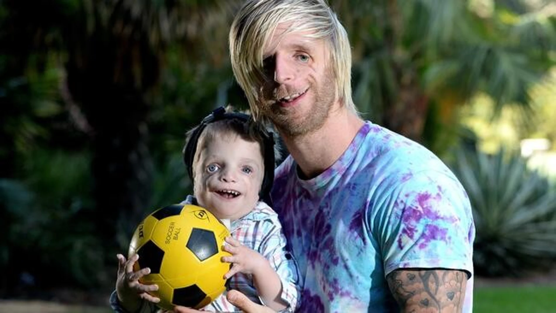 La superación y reconciliación de Jono con su vida llegó después de que fuera convocado a realizar charlas para niños, quienes le mostraron la otra cara de la moneda
