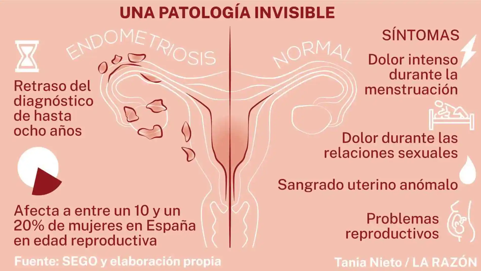¿Cómo influye el embarazo en la endometriosis?