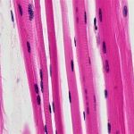 Fibras musculares esqueléticas.