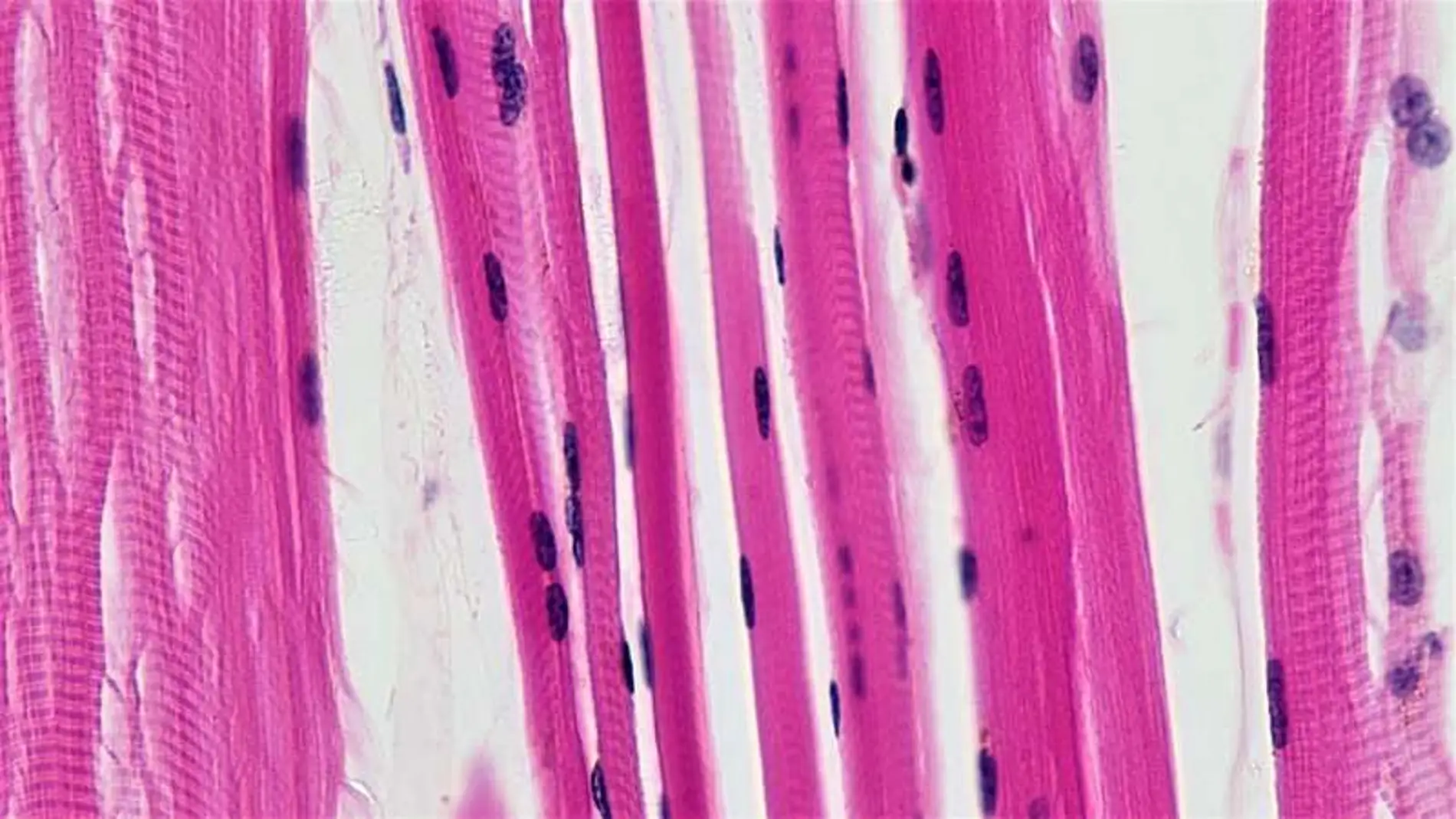 Fibras musculares esqueléticas.