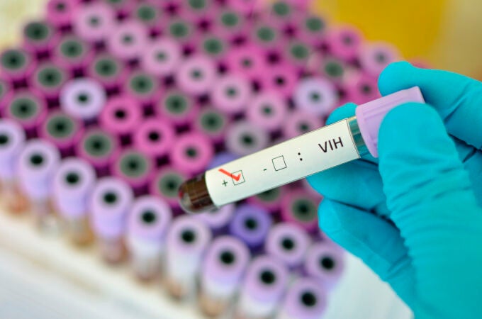 Test VIH Test VIH