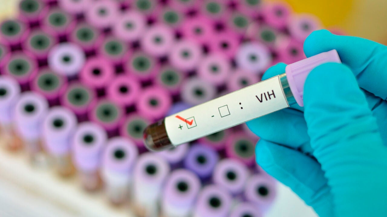 Nuevo avance científico en la lucha contra el VIH en España.