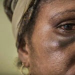 Una mujer en el centro de apoyo familiar de Port Moresby, Papúa Nueva Guinea