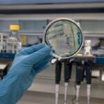 Cultivo de la bacteria "Klebsiella Pneumoniae"