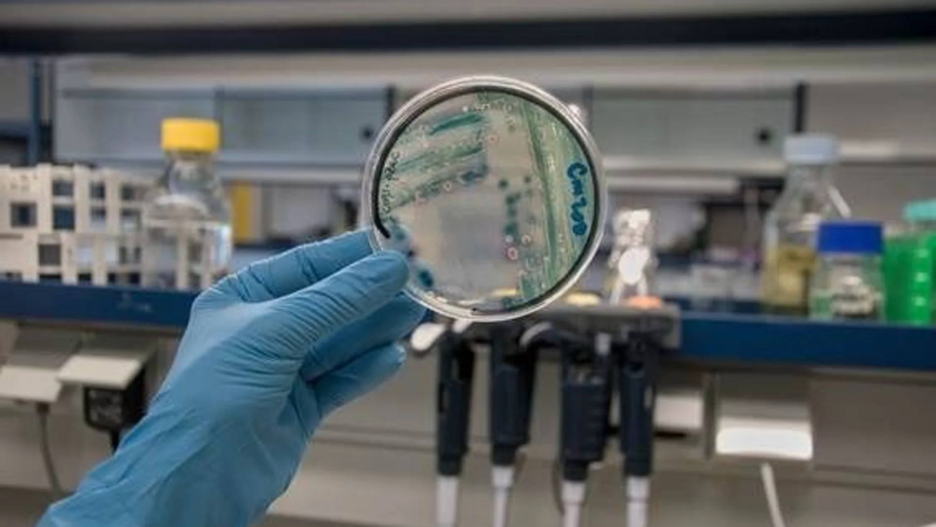 Cultivo de la bacteria "Klebsiella Pneumoniae"
