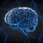 Imagen análisis de un cerebro