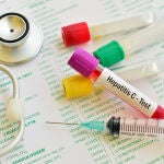 El proyecto FaCilita, puesto en marcha por la AEEH, proporciona tests de detección de la enfermedad a las poblaciones de difícil acceso al sistema sanitario