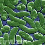 Imagen macro de la bacteria "vibrio vulnificus"