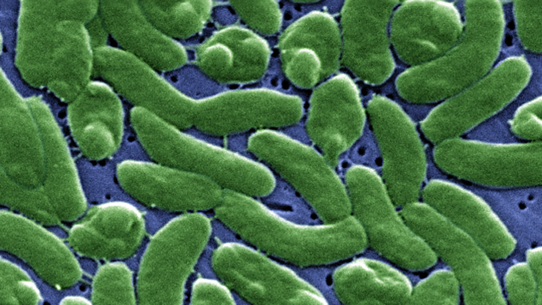 Imagen macro de la bacteria "vibrio vulnificus"