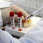 Pruebas para la gripe porcina en un laboratorio