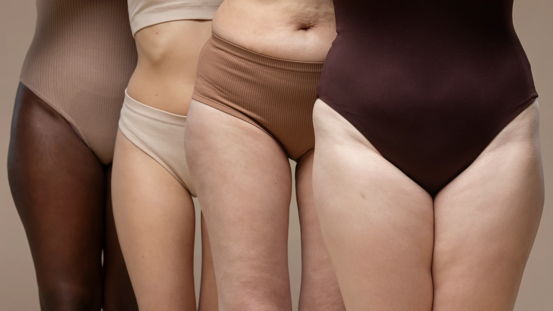 Lipedema
